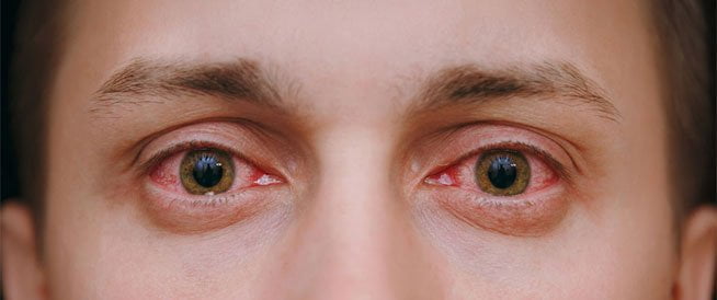 خطوات سحريه لعلاج امراض العيون