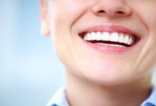ابتسامة مستقيمة بلا تحديدات: اكتشف سحر تقويم الأسنان بواسطة التقويم الشفاف