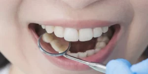 زراعة الأسنان-الحل الحديث لابتسامة مثالية ووظائف فم صحية