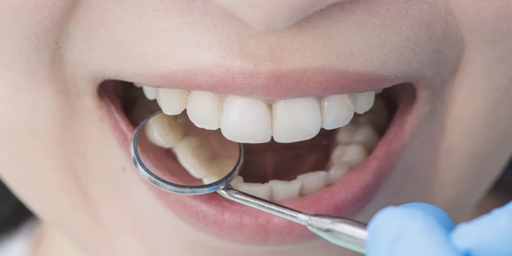 زراعة الأسنان: الحل الحديث لابتسامة مثالية ووظائف فم صحية