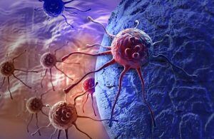 سرطان البروستاتا-حماية صحة الرجال والمكافحة المبكرة
